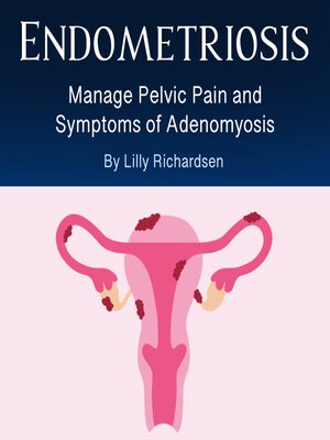 cover image of Endometriosis